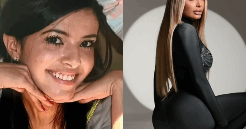 Nova apresentadora do Miss Bumbum investiu R$ 300 mil em cirurgias para alcançar corpo perfeito