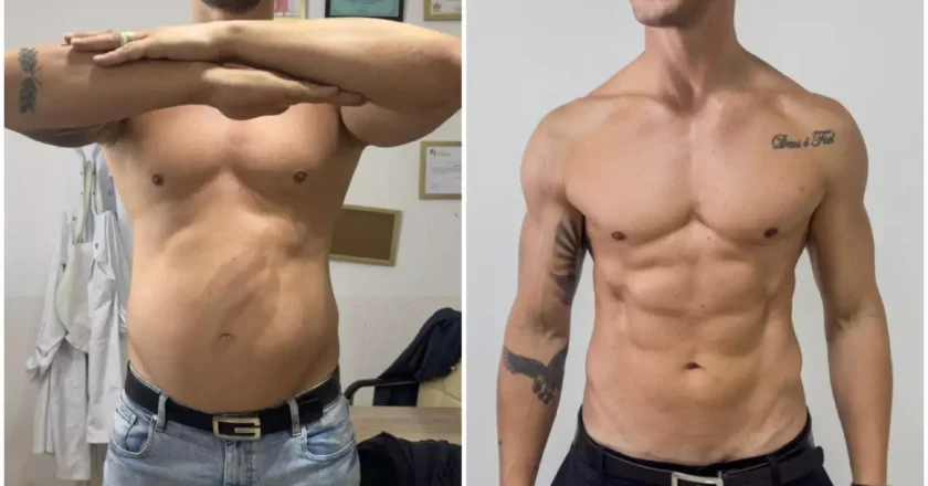 Ex-participante de reality show exibe transformação impressionante após emagrecer 23 kg