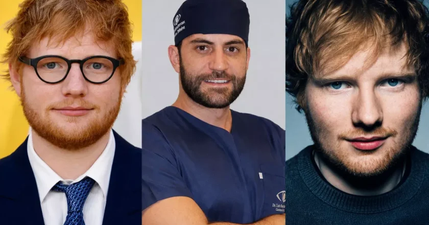 Dr. Luís Felipe Bortolan esclarece motivos pelos quais Ed Sheeran continua a usar óculos após cirurgia ocular
