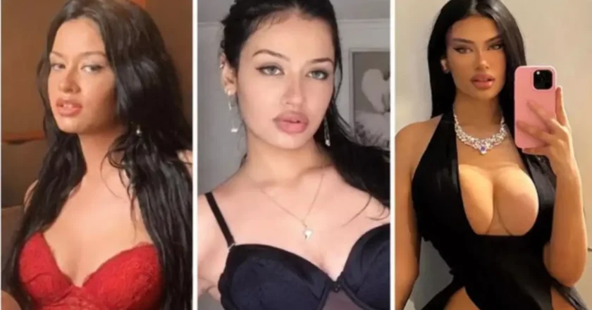 Sósia brasileira de Kylie Jenner revela que não se identifica em suas próprias imagens após procedimentos estéticos