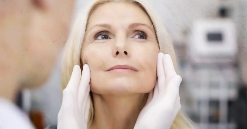 Facelift Deep Plane se destaca pela naturalidade dos resultados; especialista desmistifica dúvidas comuns